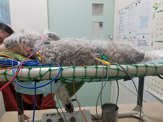 脊髄梗塞　症例動画(6)